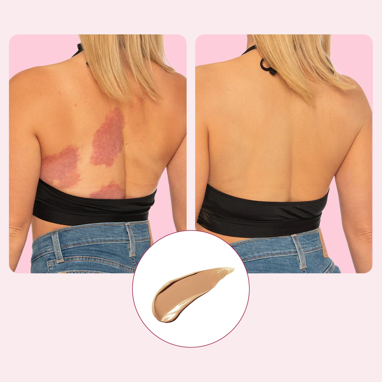 Body Coverage Perfector (VIP)
