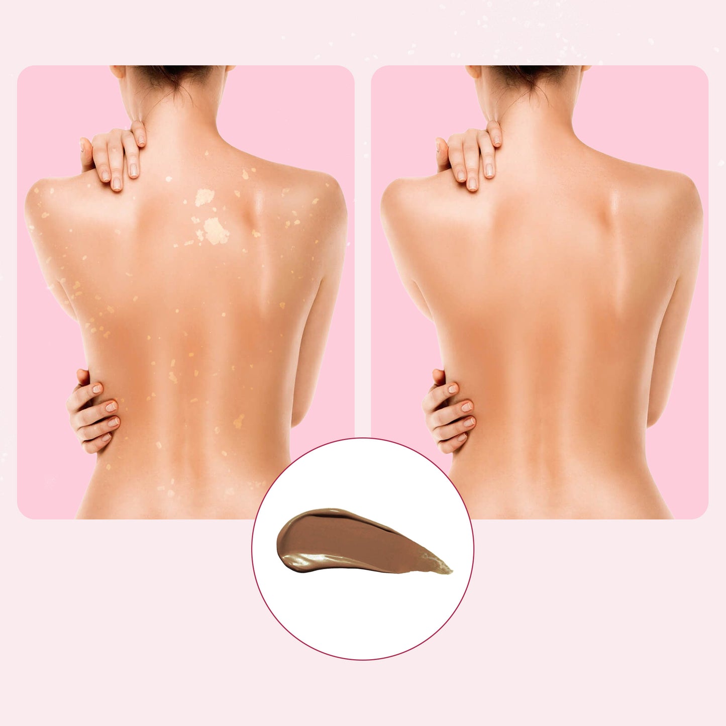 Body Coverage Perfector (VIP)