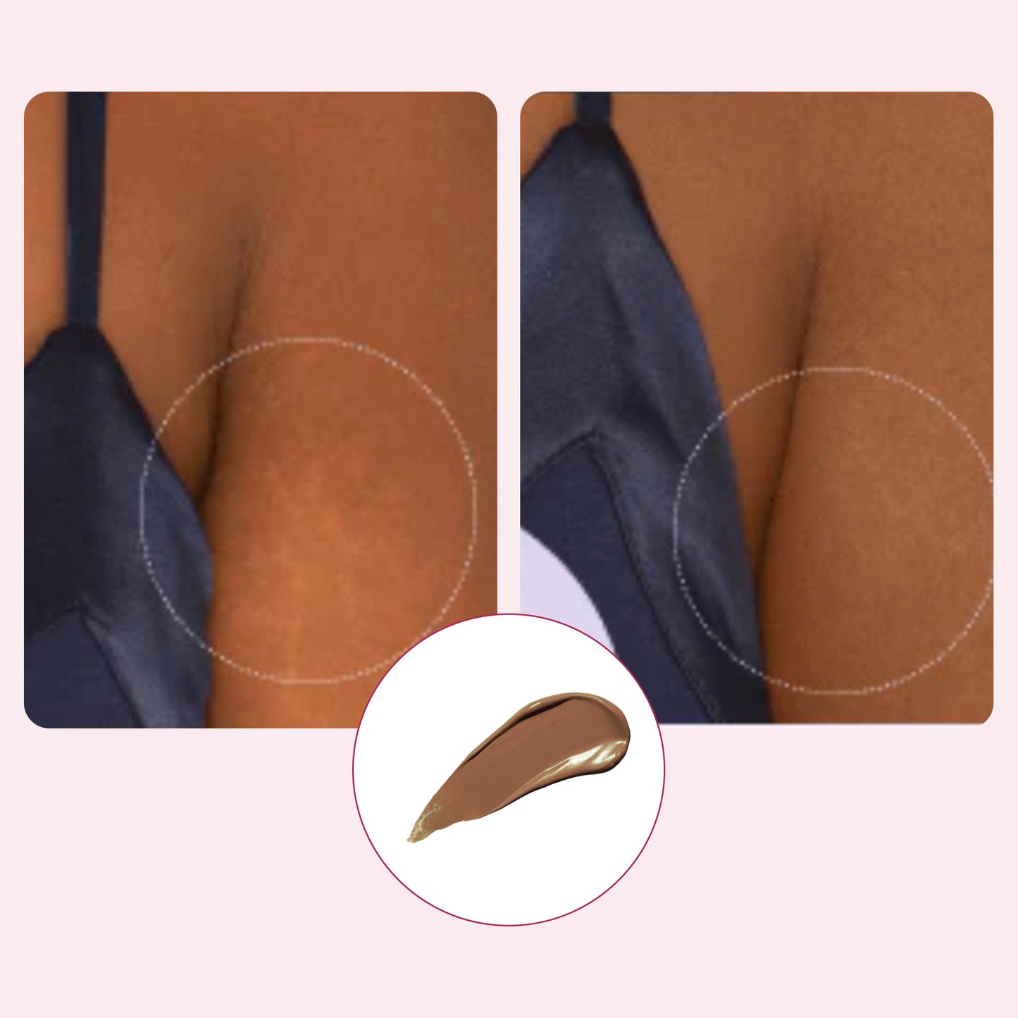 Body Coverage Perfector (VIP)