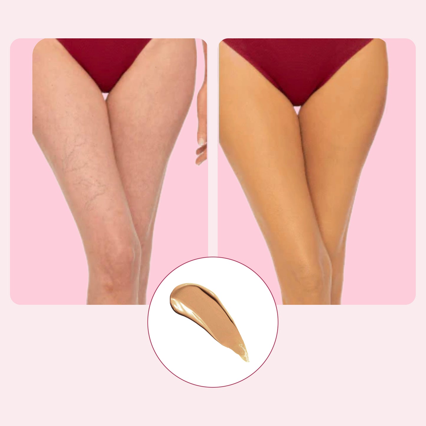Body Coverage Perfector (VIP)
