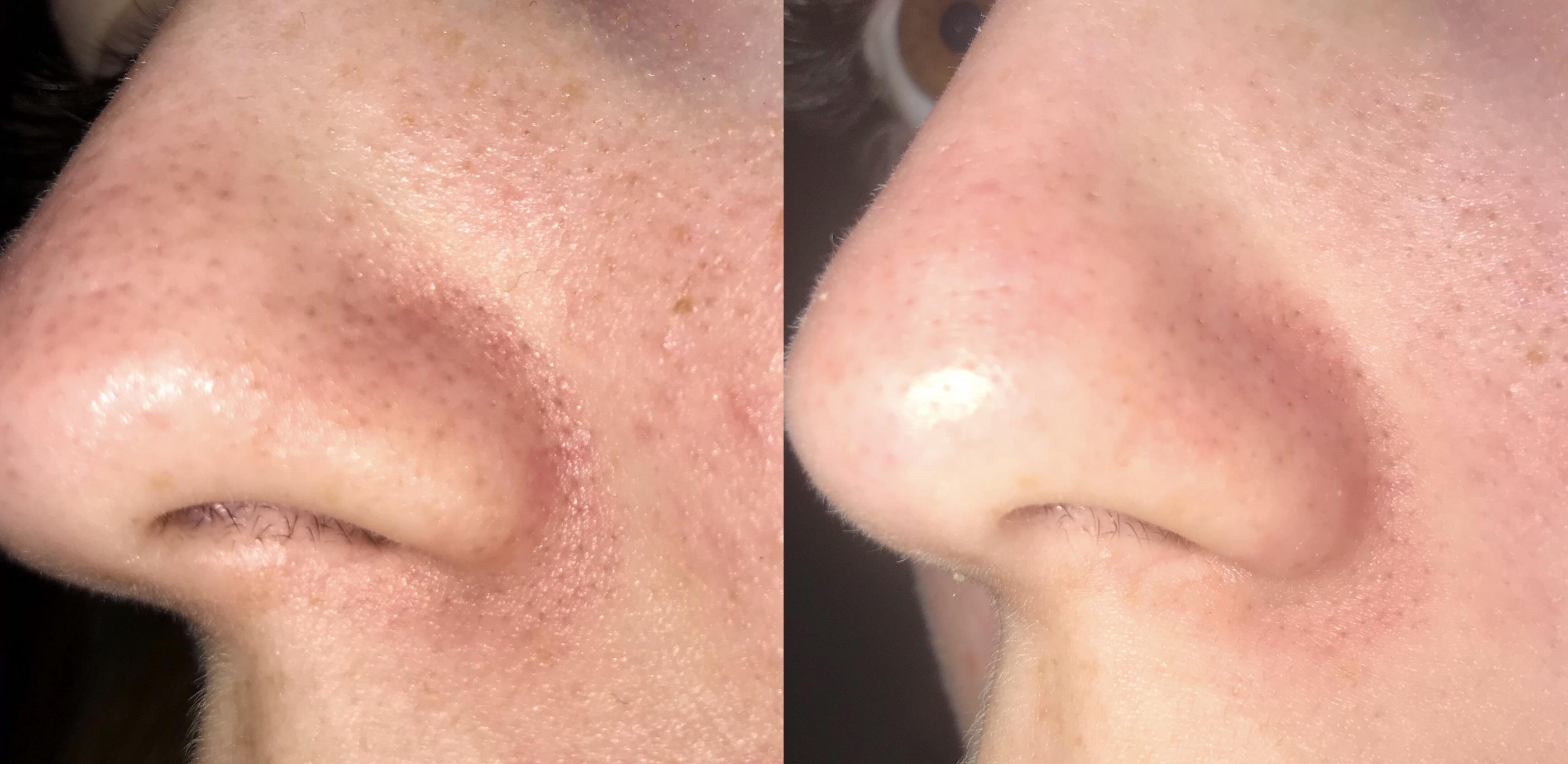 Instant & Effective Results
