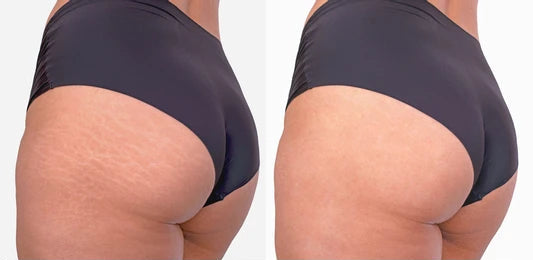 Instant & Effective Coverage